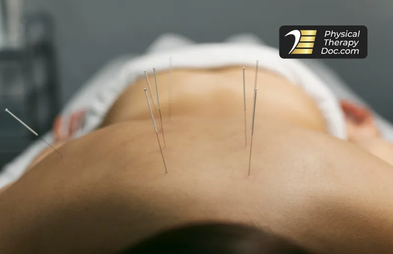 Dry needling session with Dr. Vlad Madorsky at Physical Therapy Doc in Boca Raton